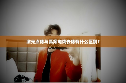 激光点痣与高频电烧去痣有什么区别？